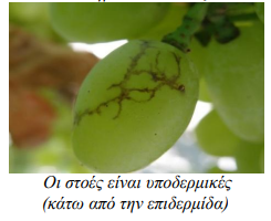 STOES YPODERMIKES