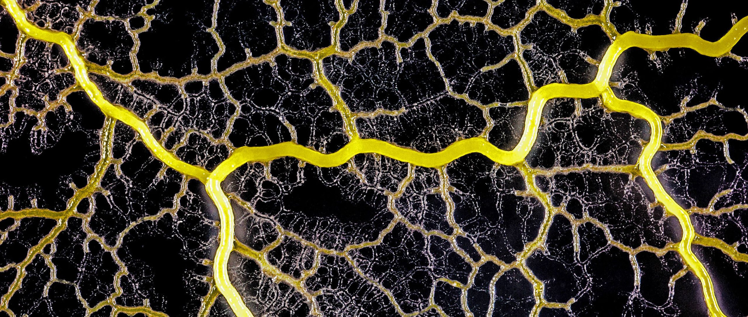 bacteria1