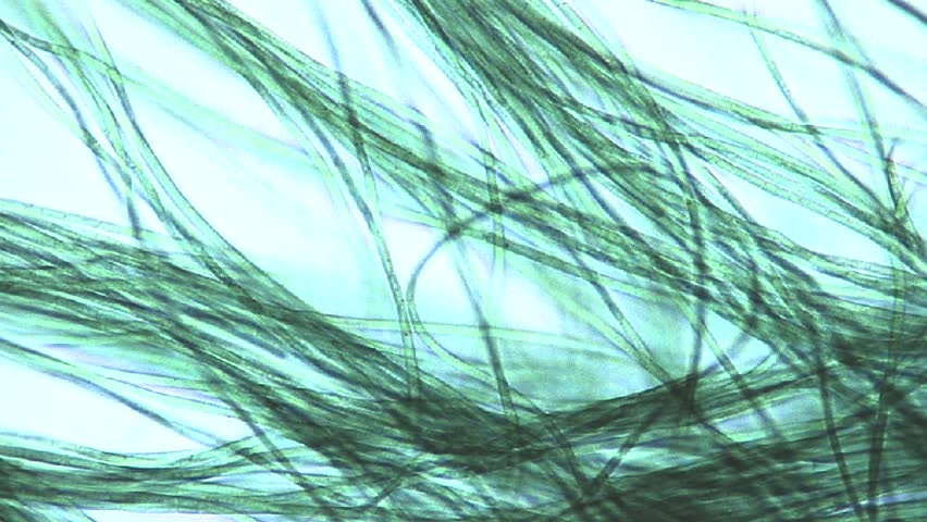 cyanobacteria