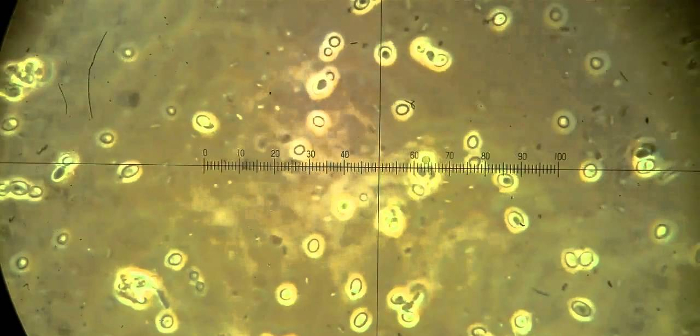 trichoderma4
